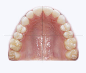Please upload a picture like the one in the sample